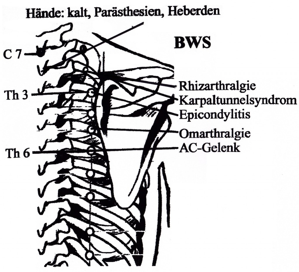 BWS Somatotop